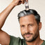 Man using Hairgenetix mesotherapy pen for hair growth scalp treatment