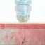 Hairgenetix Meso Infusion Stamp Box